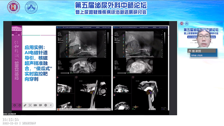 卡本VENUS多模态影像融合超声诊断系统推进湖南省前列腺癌穿刺活检精准诊疗高质量发展