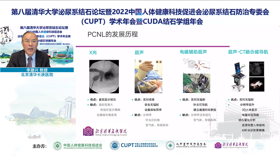 卡本医疗携手清华长庚医院推进PCNL精准诊疗新发展，将促进泌尿外科疾病治疗向精准化、微创化方向迈进，加快泌尿外科病患者术后恢复，节约医疗成本。