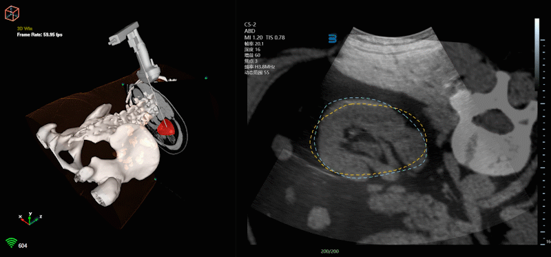 卡本医疗VENUS多模态影像融合超声诊断系统临床启动会现场