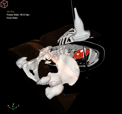 卡本VENUS多模态超声诊断系统3D重建器官