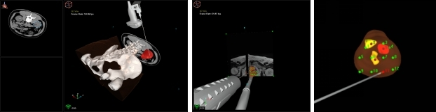 精准、便捷、安全、高效&nbsp;|&nbsp;卡本医疗VENUS推动我国泌尿外科创新发展