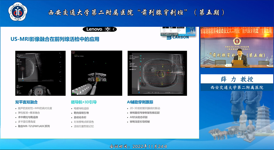 卡本VENUS多模态影像融合超声系统赋能西安交通大学第二附属医院前列腺精准靶向穿刺新突破