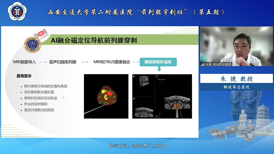 卡本VENUS多模态影像融合超声系统赋能西安交通大学第二附属医院前列腺精准靶向穿刺新突破