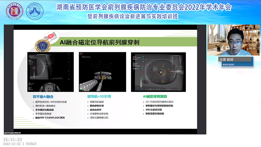 卡本VENUS多模态影像融合超声诊断系统推进湖南省前列腺癌穿刺活检精准诊疗高质量发展