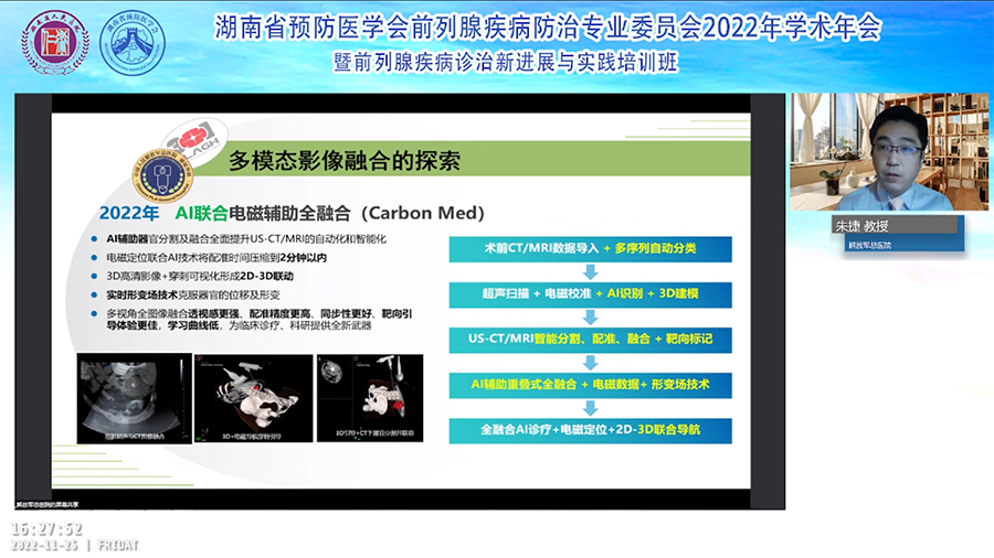 卡本VENUS多模态影像融合超声诊断系统推进湖南省前列腺癌穿刺活检精准诊疗高质量发展