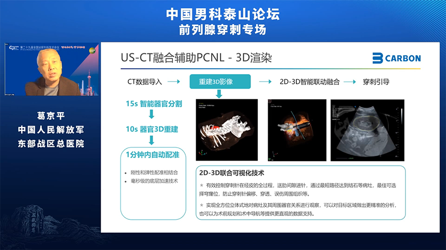 卡本VENUS多模态影像融合超声为泌尿外科患者提供更为精准的诊疗方案