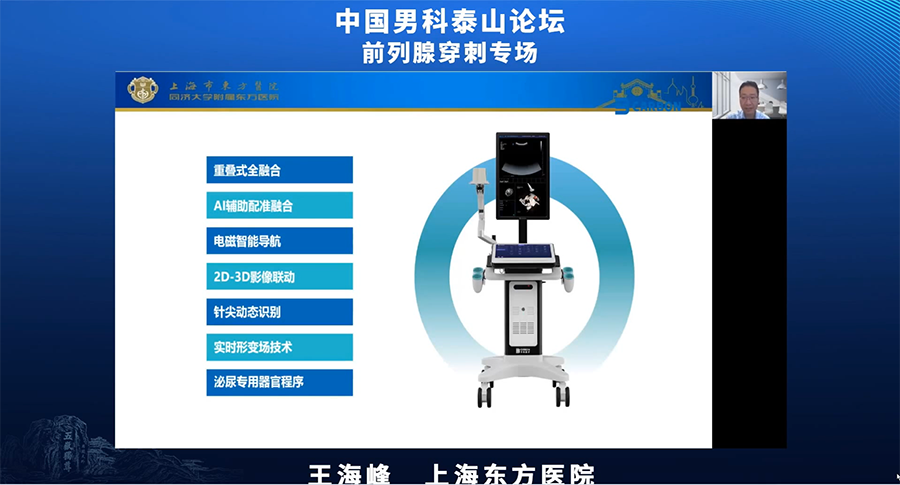 卡本VENUS多模态影像融合超声为泌尿外科患者提供更为精准的诊疗方案