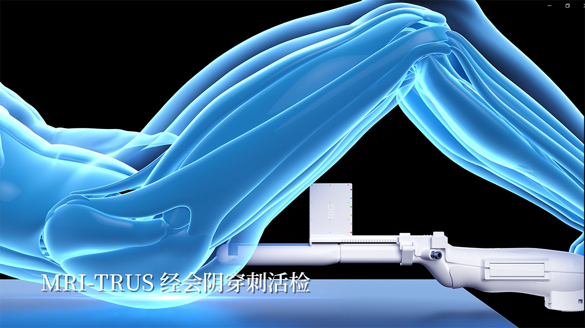 卡本VENUS入选《深圳市创新产品推广应用目录》助力推进我国精准医疗发展，有助于为患者提供更精准的诊疗方案，提升我国医疗器械和临床科学水平